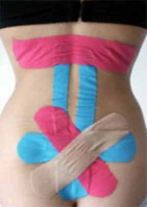 Kinesiotape.jpg